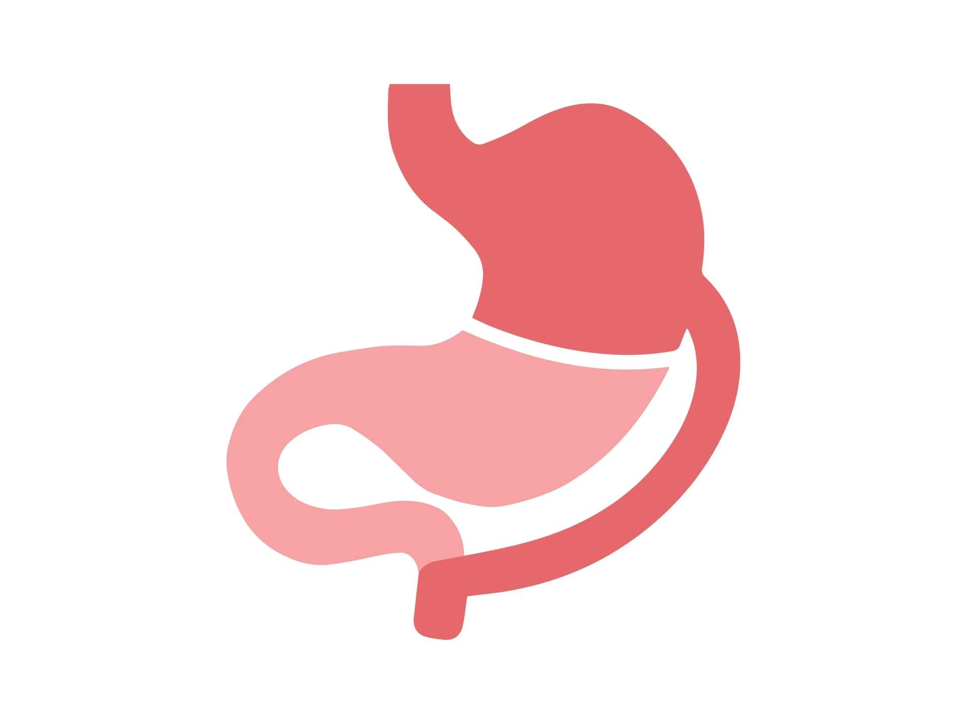 Gastric Bypass Surgery