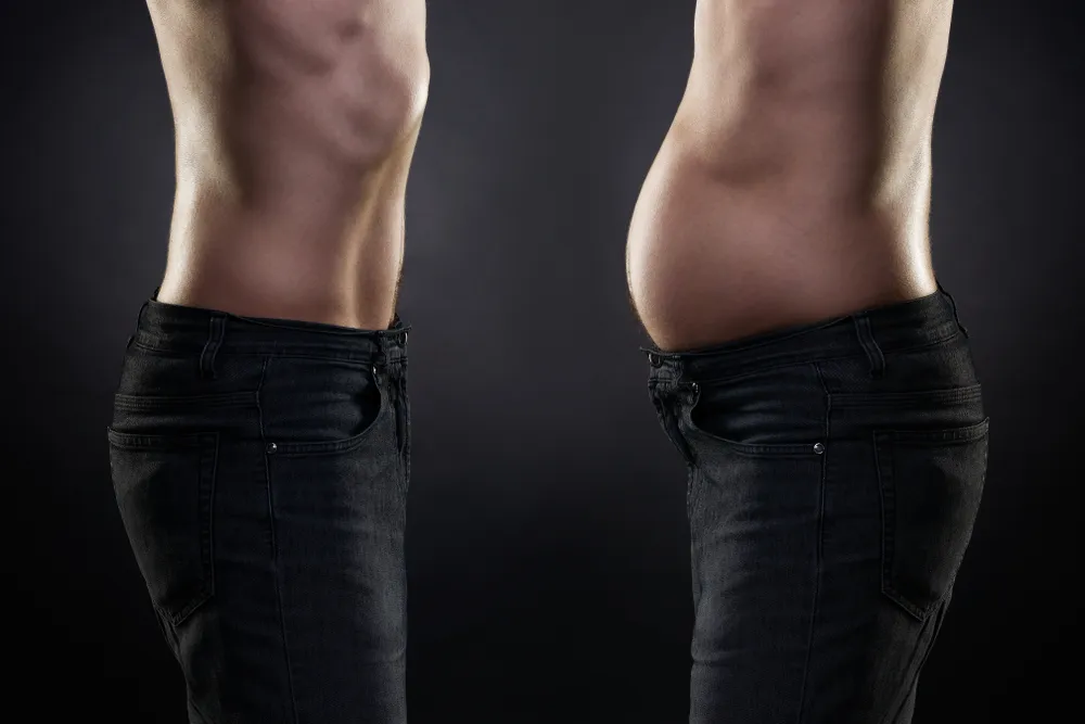 Tummy Tuck (Abdominoplasty)