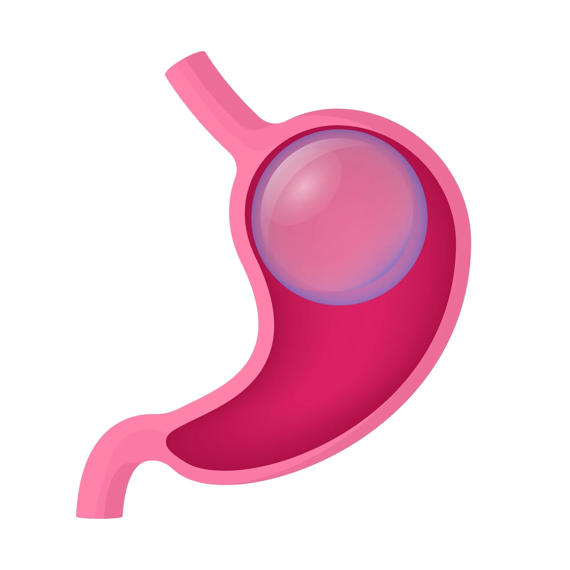 Gastric Balloon & Smart Capsule